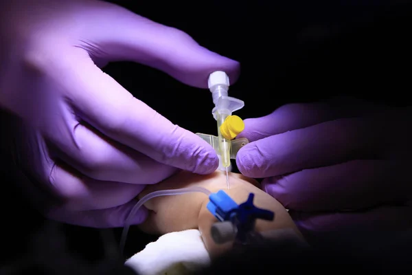 Anestezi uzmanı kümeleri Childs kateter