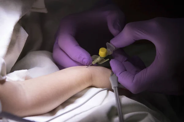 Catheter Installation into Baby Arm — Stock Photo, Image