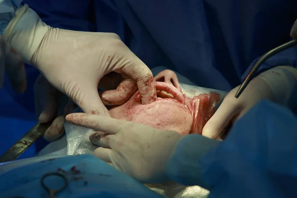 Çene Cerrahisi yakın çekim