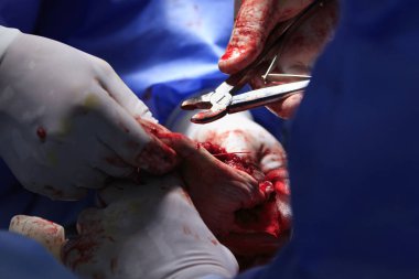 Kan Jet ve Kerpetenler