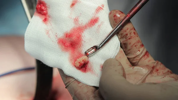 Chirurgische bot lepel en een beendermateriaal close-up — Stockfoto