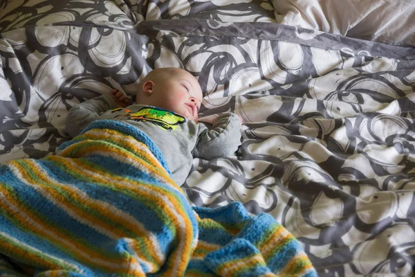 Lindo bebé con síndrome de Down durmiendo en la cama — Foto de Stock