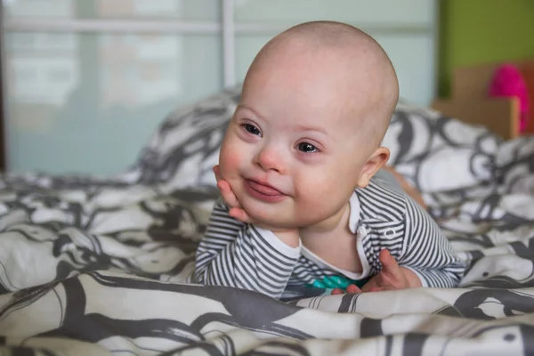 Portrait of cute baby boy with Down syndrome — Stock Photo, Image