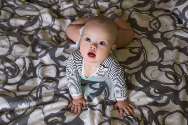 Retrato de bebé lindo con síndrome de Down — Foto de Stock