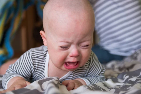 Cute baby boy with Down syndrome crying — Stock Photo, Image