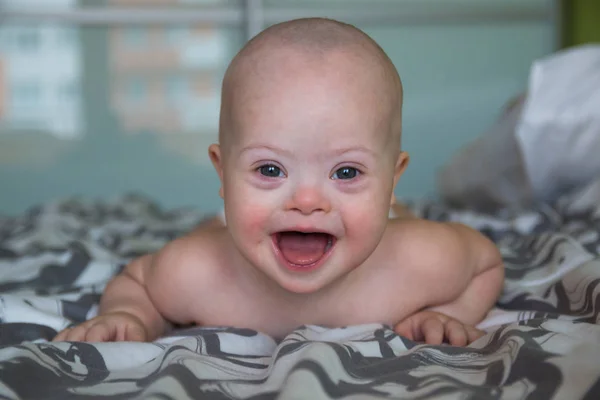 Portrait of cute baby boy with Down syndrome — Stock Photo, Image