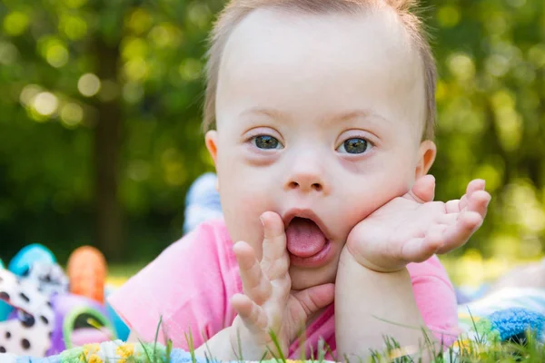 Portrait of Cute baby boy with Down syndrome lying on blanket in summer day on nature — Stock Photo, Image