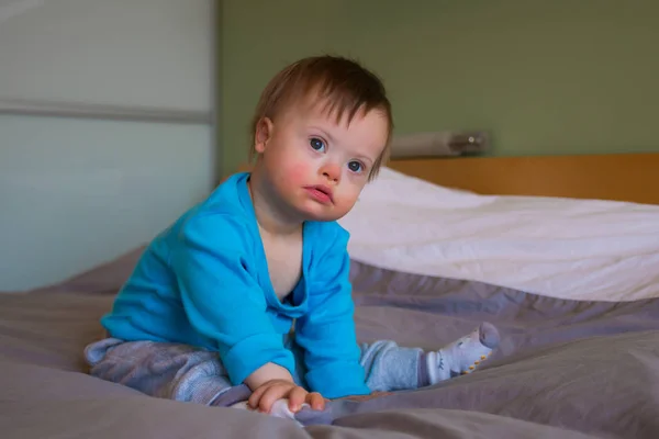 Portrait of cute baby boy with Down syndrome — Stock Photo, Image