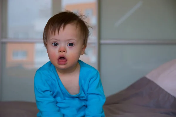 Portret van schattige baby jongen met Down syndroom — Stockfoto