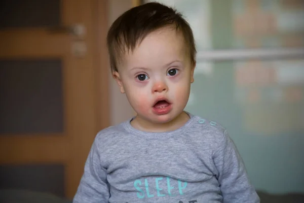 Portrait of cute baby boy with Down syndrome — Stock Photo, Image