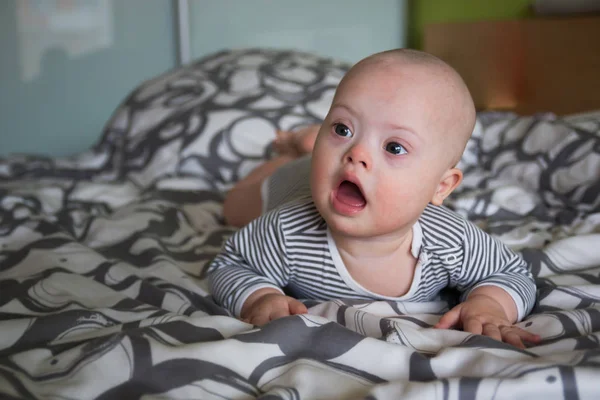 Retrato de bebé lindo con síndrome de Down — Foto de Stock