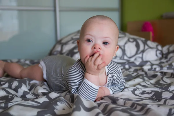 Retrato de bebé lindo con síndrome de Down — Foto de Stock