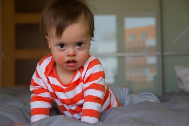 Down sendromlu şirin bir erkek bebeğin portresi.