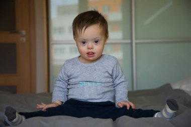 Down sendromlu şirin bir erkek bebeğin portresi.