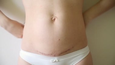 Doğum sonrası sezaryen yarası olan kadın, doğumdan sonra belini ölçüyor.