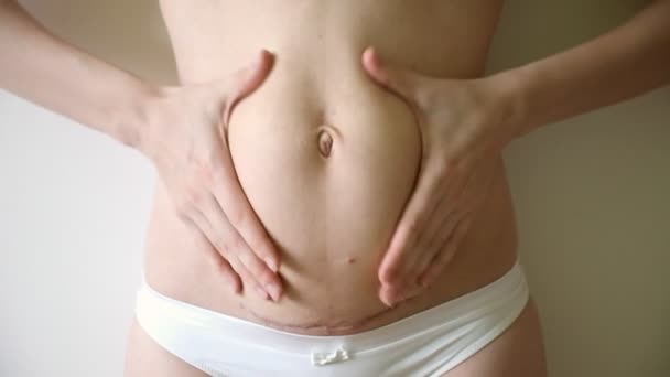 Γυναίκα αρπάζοντας το χαλαρό δέρμα στο στομάχι μετά τον τοκετό από καισαρική τομή — Αρχείο Βίντεο