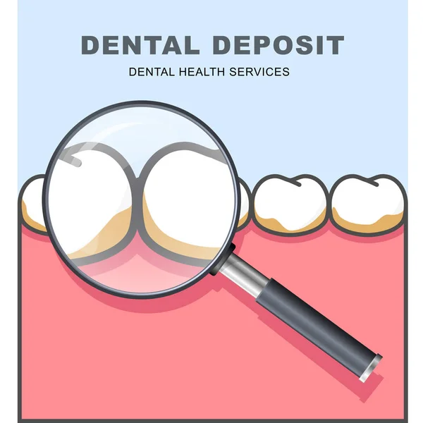 Dépôt dentaire - rangée de dents sous loupe — Image vectorielle