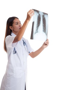 Asya genç kadın doktor bak x-rey Sineması'nda