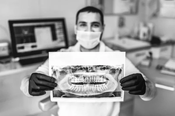 Dentista mostrando a radiografia do paciente — Fotografia de Stock