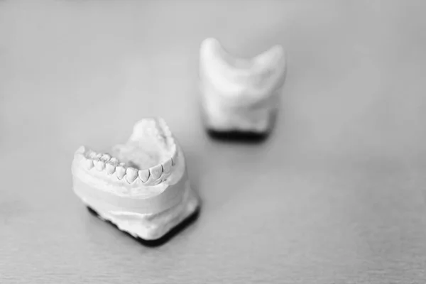 Dental gips modelu zębów — Zdjęcie stockowe