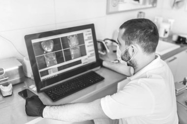 Röntgen Muayenesi yapma ve klinikte tedavi seçimi diş hekimi