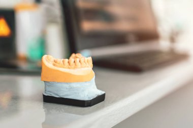 Diş alçı model diş diş Kliniği