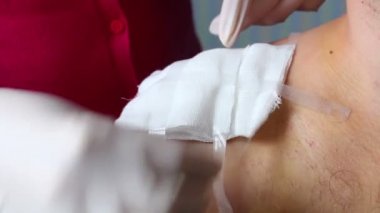 Köprücük kemiği yaralı bir adam. Lastik eldiven hemşire bir gazlı bez yaradan kaldırır. Cerrahi sütür inceler ve geri kapatır.