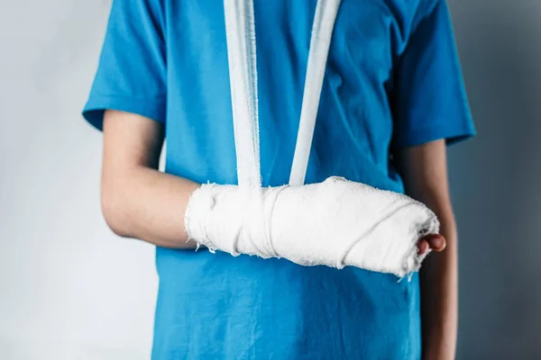 Tynkowane ramię, złamana ręka u nastolatka — Zdjęcie stockowe