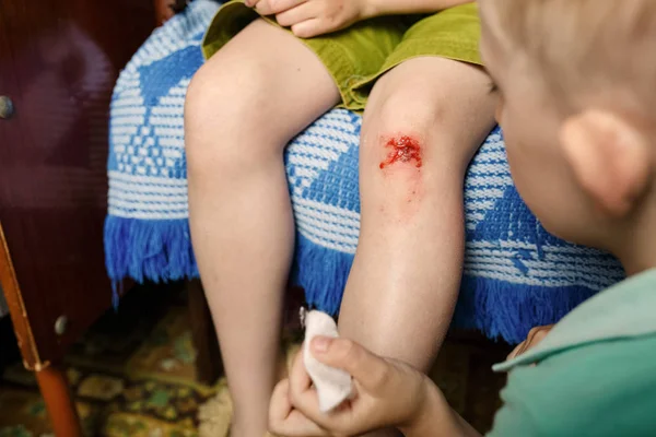 Kleines Mädchen verletzt sich am Knie, ein Junge heilt ihre Wunde — Stockfoto
