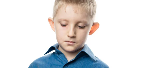 Детский глаз болезнь герпеса на лице . — стоковое фото