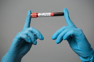 Virüs koronavirüs için kan testleri.