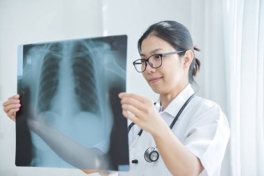 Asyalı kadın Doktor hastanın film x-ışını isteyen.