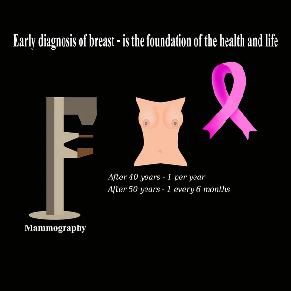 Mammografia. Diagnosi del cancro al seno. Diagnosi delle cisti nel seno. La lotta contro il cancro al seno. Cancro al nastro rosa. Illustrazione vettoriale su sfondo nero — Vettoriale Stock