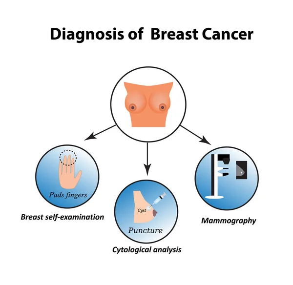 A mellrák diagnózis módszerei. Szúrt, emlő önvizsgálata, mammográfiai. A szövettani vizsgálat, citológiai. Infographics. Elszigetelt háttér vektor illusztráció — Stock Vector