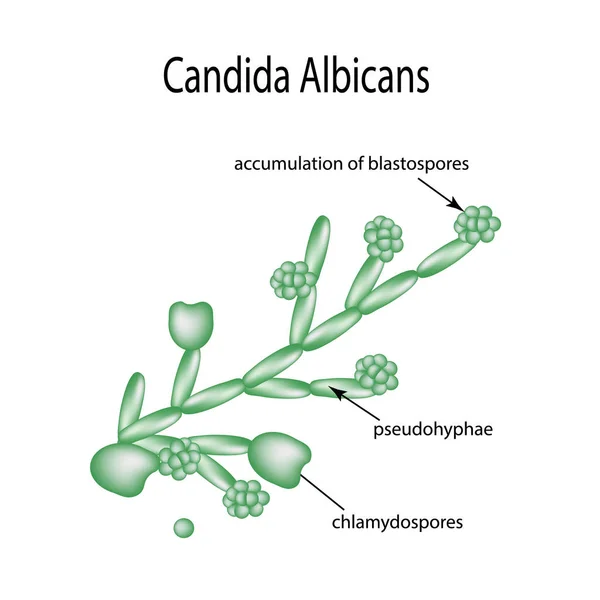 Struktura Candida albicans. Infografika. Vektorové ilustrace v izolovaných pozadí — Stockový vektor