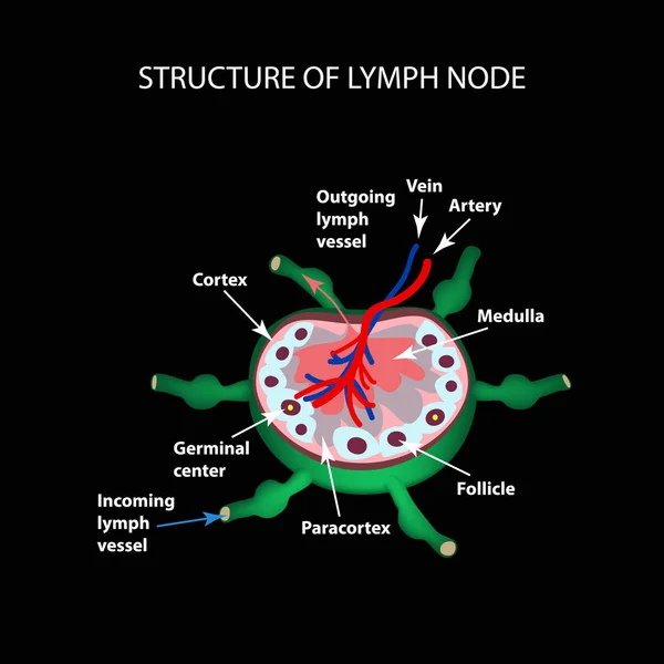 The anatomical structure of the lymph node. Infographics. Vector illustration on a black background — Stock Vector