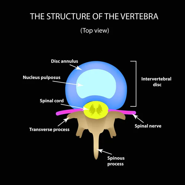 Estructura anatómica del disco intervertebral. Vista superior. Espina dorsal. Infografías. Ilustración vectorial sobre fondo negro — Archivo Imágenes Vectoriales