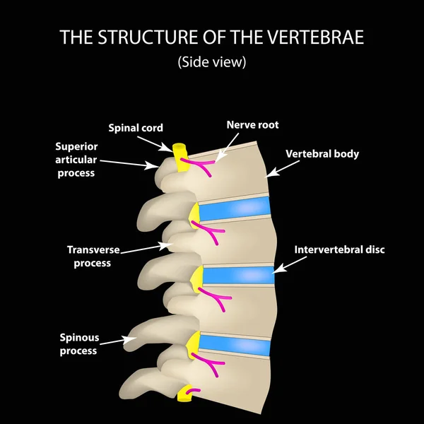 Az anatómiai felépítése a gerinc. Oldalnézet. A porckorongok. Infographics. A fekete háttér vektor illusztráció — Stock Vector