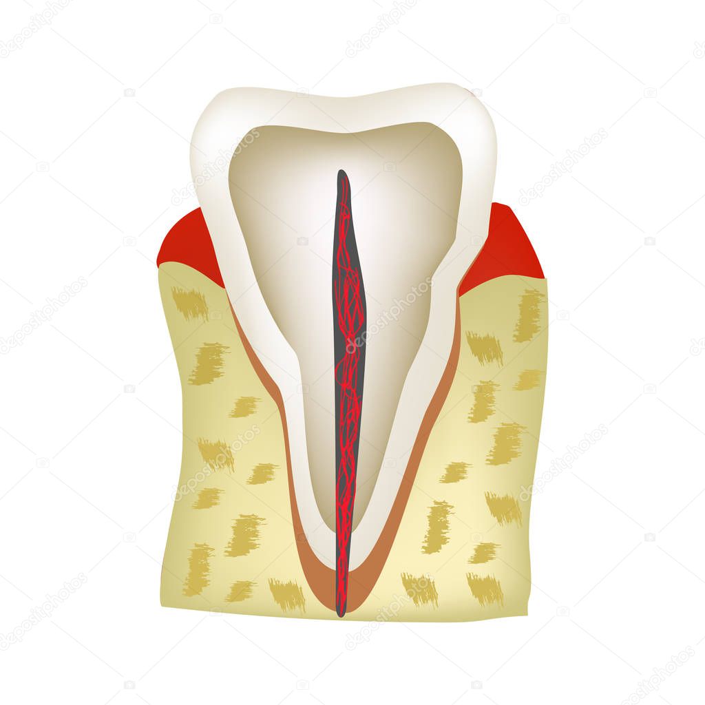 The anatomical structure of the tooth. Infographics. Vector illustration on isolated background
