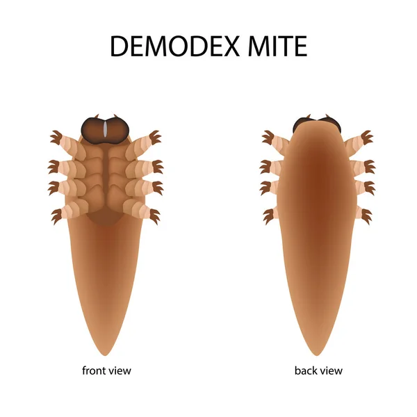 The structure of the demodex mite. Front view and rear view. Demodecosis. Infographics. Vector illustration on isolated background. — Stock Vector