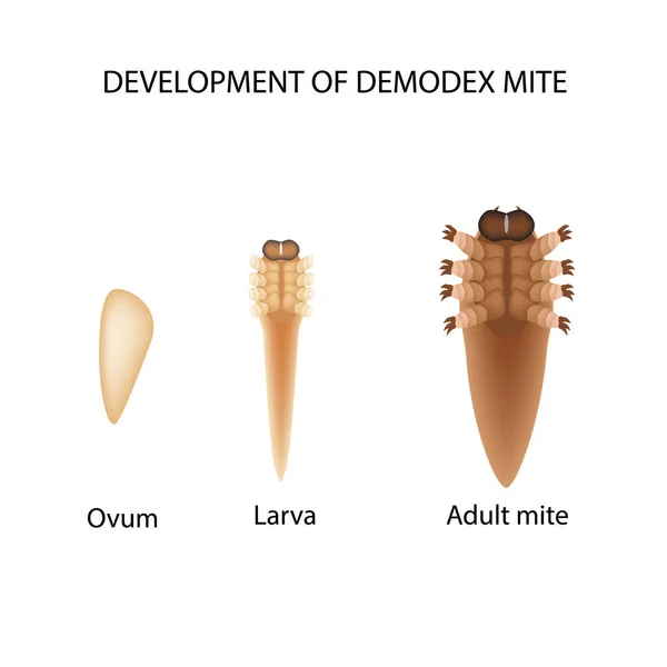 Demodex たにの再現。大人の幼虫。Demodecosis。インフォ グラフィック。孤立した背景のベクトル図. — ストックベクタ