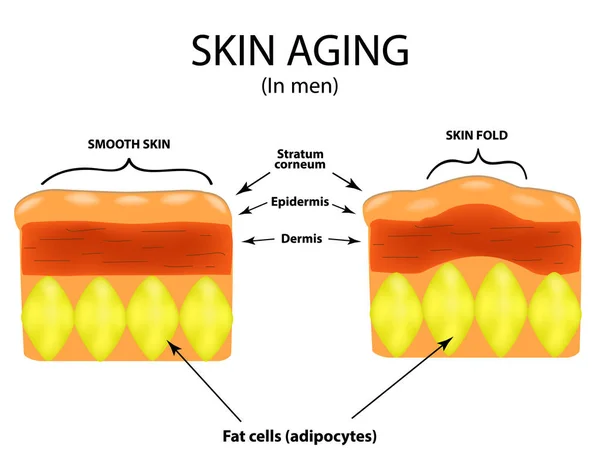 Invecchiamento della pelle negli uomini. Infografica. Illustrazione vettoriale su sfondo isolato — Vettoriale Stock
