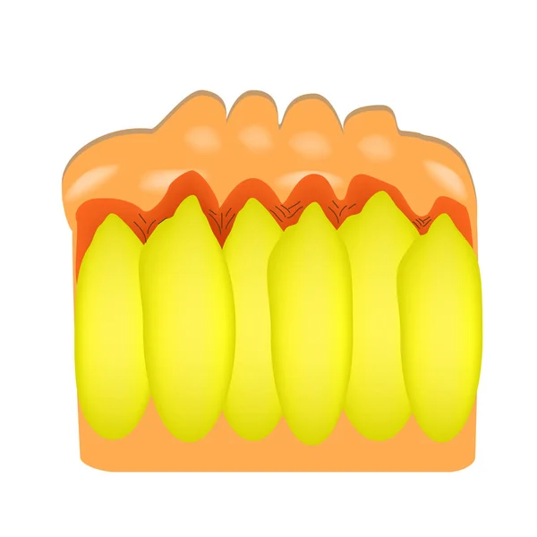 Veroudering van de huid bij vrouwen. Cellulitis (sinaasappelhuid). Infographics. Vectorillustratie op geïsoleerde achtergrond — Stockvector