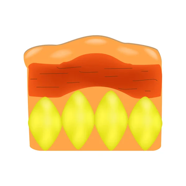 Vieillissement cutané chez les hommes. Cellulite. Infographie. Illustration vectorielle sur fond isolé — Image vectorielle