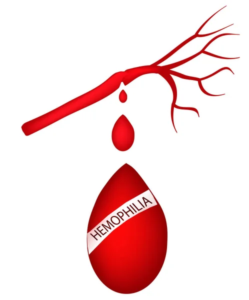 Día Mundial de la Hemofilia. 17 de abril. Una gota de sangre que fluye de la arteria. Ilustración vectorial — Vector de stock