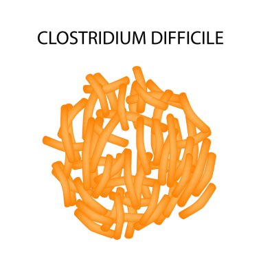 Clostridium difficile. Pathogenic flora. The bacterium causes intestinal diseases. Infographics. Vector illustration. clipart