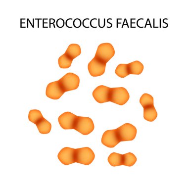 Enterococcus faecalistir. Patojenik flora. Bakteri bağırsak hastalıkları neden olur. Infographics. Vektör çizim.