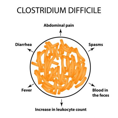 Clostridium difficile. Pathogenic flora. The bacterium causes intestinal diseases. Symptoms of infection. Infographics. Vector illustration. clipart