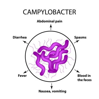 Campylobacter. Patojenik flora. Bakteri bağırsak hastalıkları neden olur. Enfeksiyon belirtileri. Infographics. Vektör çizim.