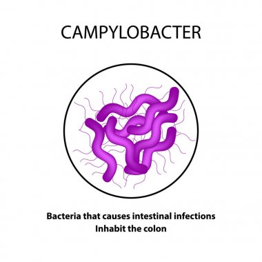 Campylobacter. Patojenik flora. Bakteri bağırsak hastalıkları neden olur. Infographics. Vektör çizim.